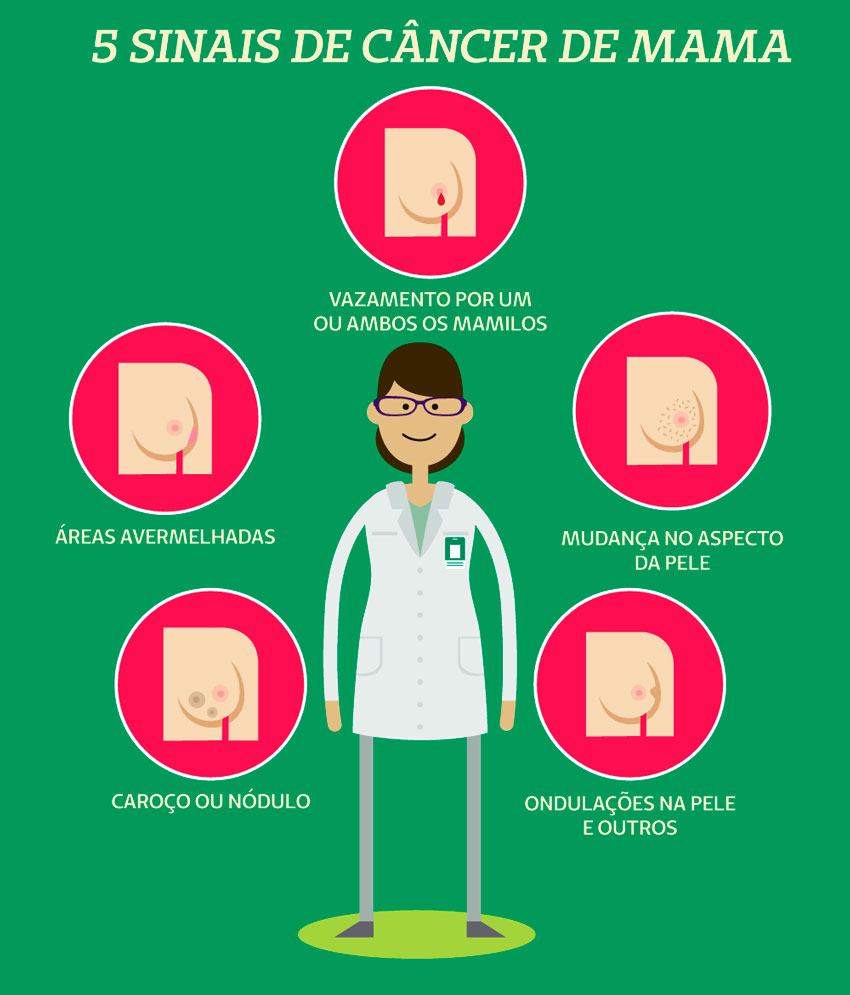 Infográfico com os cinco sinais de câncer de mama