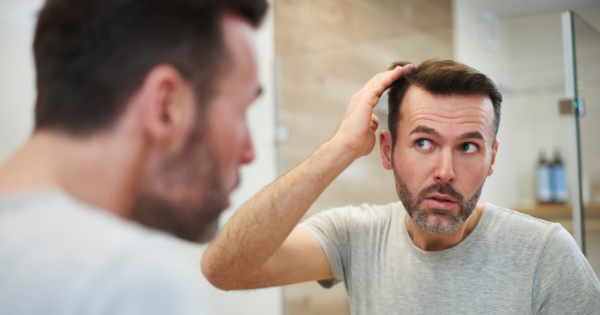 Alopecia: como saber se essa é a causa da sua queda de cabelo?